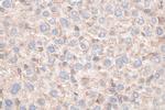 MYD88 Antibody in Immunohistochemistry (Paraffin) (IHC (P))