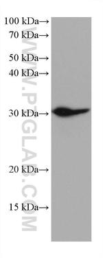 MYD88 Antibody in Western Blot (WB)