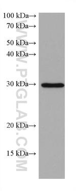 MYD88 Antibody in Western Blot (WB)