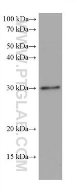 MYD88 Antibody in Western Blot (WB)