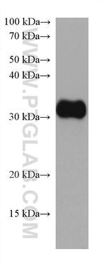 MYD88 Antibody in Western Blot (WB)