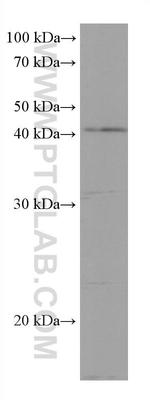 DHODH Antibody in Western Blot (WB)