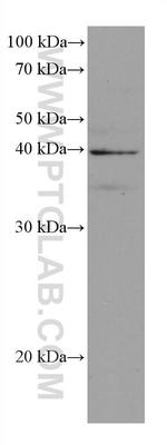 DHODH Antibody in Western Blot (WB)