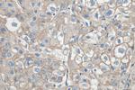 SPTBN1 Antibody in Immunohistochemistry (Paraffin) (IHC (P))