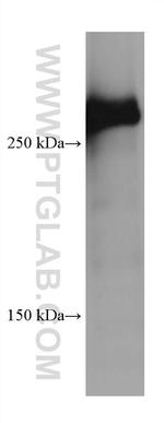 SPTBN1 Antibody in Western Blot (WB)