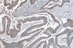 SHMT2 Antibody in Immunohistochemistry (Paraffin) (IHC (P))