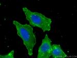 FAH Antibody in Immunocytochemistry (ICC/IF)