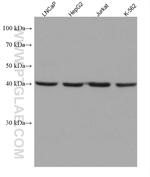 FAH Antibody in Western Blot (WB)