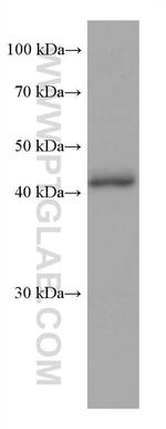 FAH Antibody in Western Blot (WB)