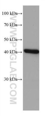 FAH Antibody in Western Blot (WB)