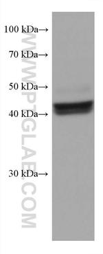 FAH Antibody in Western Blot (WB)