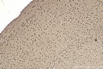 RAD23B Antibody in Immunohistochemistry (Paraffin) (IHC (P))