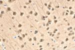 RAD23B Antibody in Immunohistochemistry (Paraffin) (IHC (P))