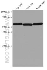 RAD23B Antibody in Western Blot (WB)