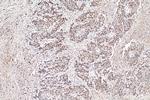 MMP7 Antibody in Immunohistochemistry (Paraffin) (IHC (P))