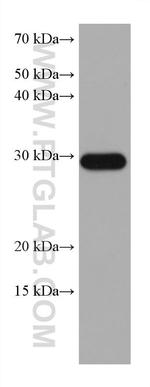 MMP7 Antibody in Western Blot (WB)