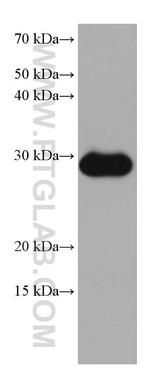 MMP7 Antibody in Western Blot (WB)