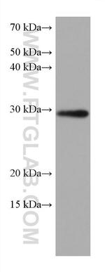 MMP7 Antibody in Western Blot (WB)