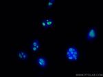 MYBBP1A Antibody in Immunocytochemistry (ICC/IF)