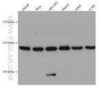 MYBBP1A Antibody in Western Blot (WB)