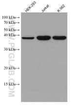 DHPS Antibody in Western Blot (WB)