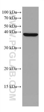 DHPS Antibody in Western Blot (WB)