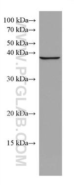 DHPS Antibody in Western Blot (WB)