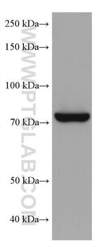 TGM2 Antibody in Western Blot (WB)