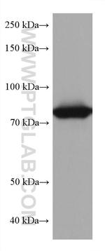 TGM2 Antibody in Western Blot (WB)