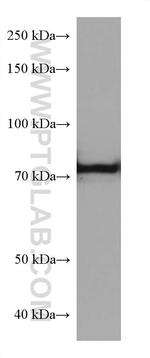 TGM2 Antibody in Western Blot (WB)