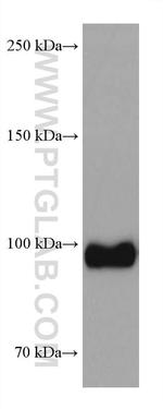 Sortilin Antibody in Western Blot (WB)