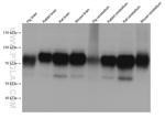 KCNA1 Antibody in Western Blot (WB)