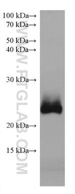 RAB39B Antibody in Western Blot (WB)