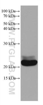 RAB39B Antibody in Western Blot (WB)