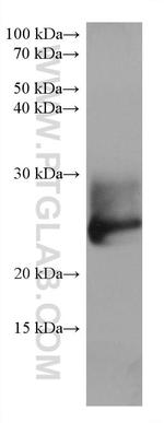 RAB39B Antibody in Western Blot (WB)