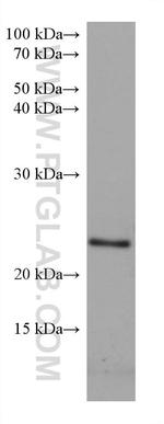 RAB39B Antibody in Western Blot (WB)