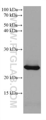 RAB39B Antibody in Western Blot (WB)