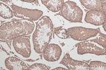 STK11 Antibody in Immunohistochemistry (Paraffin) (IHC (P))