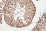 STK11 Antibody in Immunohistochemistry (Paraffin) (IHC (P))