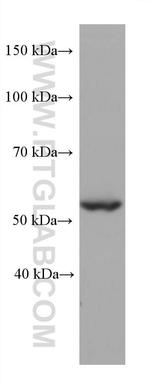 STK11 Antibody in Western Blot (WB)