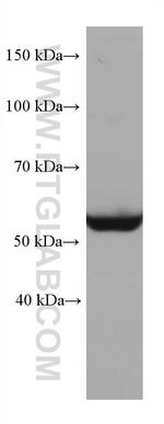 STK11 Antibody in Western Blot (WB)