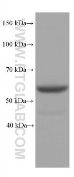 STK11 Antibody in Western Blot (WB)