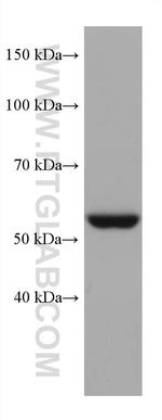 STK11 Antibody in Western Blot (WB)