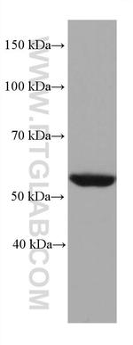 STK11 Antibody in Western Blot (WB)