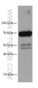 ACOX1 Antibody in Western Blot (WB)