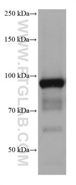 ALDH1L1 Antibody in Western Blot (WB)