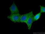 AGT Antibody in Immunocytochemistry (ICC/IF)