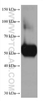 AGT Antibody in Western Blot (WB)