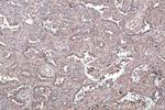 CRMP1 Antibody in Immunohistochemistry (Paraffin) (IHC (P))