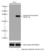 Phospho-EIF2S1 (Ser51) Antibody in Western Blot (WB)